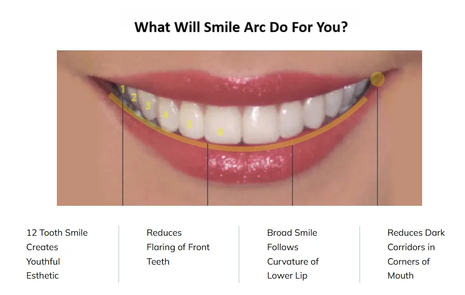 Smile Arc