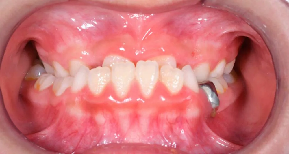 Before