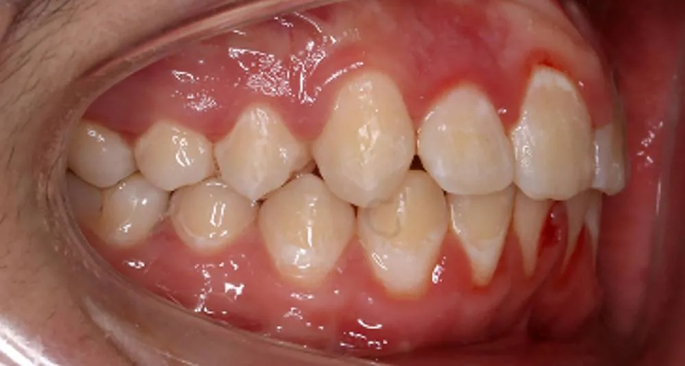 After