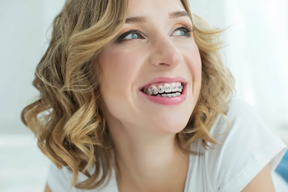 Invisalign