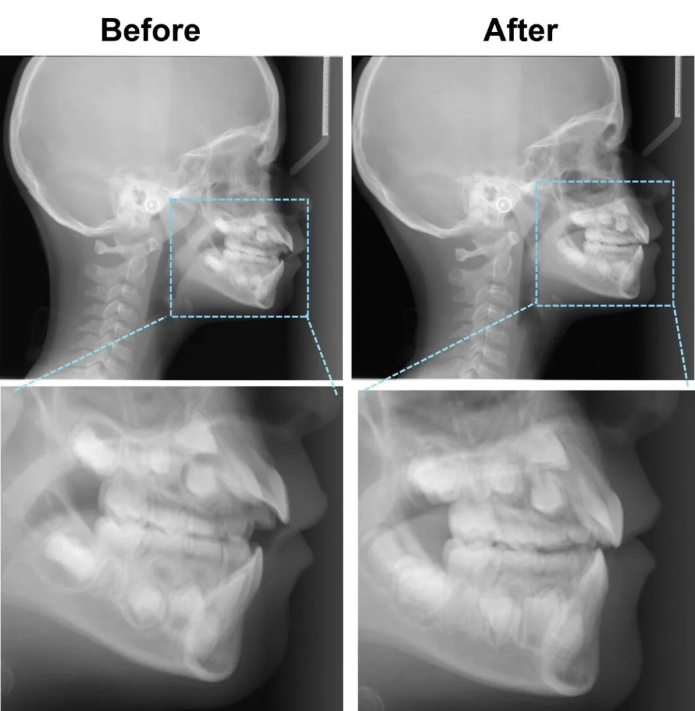 Cleft and Craniofacial Treatment